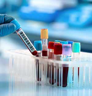 Lab Testing Near Me in Plymouth, MI and Bloomfield Hills, MI Lab Testing Near Me in Plymouth, MI and Bloomfield Hills, MI